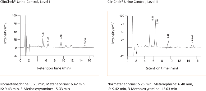 Chromatogramm Metanephrine Urin